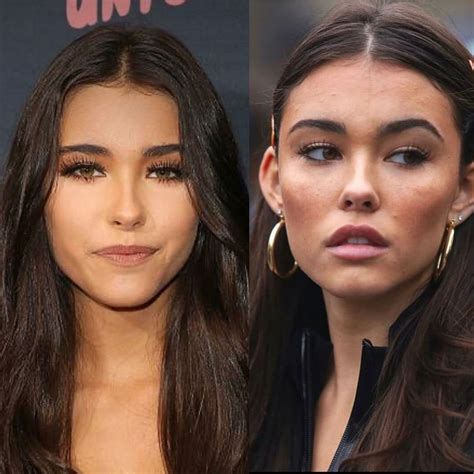 Madison Beer Plastic Surgery: Quotes, Before, After Photos.